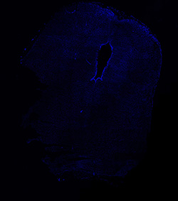 13PCW human midbrain